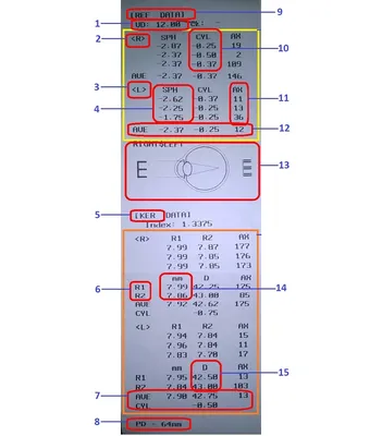 Расшифровка Авторефрактометра - Onlinza.com