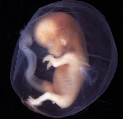Lifemodels.ru — Материалы против абортов, муляжи, модели эмбрионов