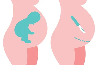 25 неделя беременности: что происходит, развитие и шевеление плода, как  лежит ребенок, УЗИ
