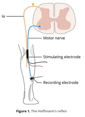 Stretch reflex (myotatic reflex): Definition, pathway | GetBodySmart