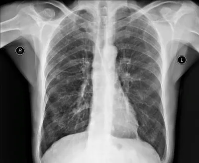 Рентгенограммы органов грудной клетки: [Часть 1]