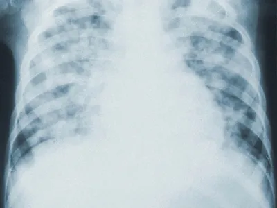 Рентген легких в Челябинске — цена в Клинике