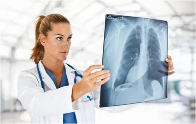 Рентген легких в Москве - сделать рентгенографию легких по оптимальной цене  | ЛДЦ Кутузовский