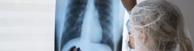 Рентген легких – цена в Москве, сделать рентгенографию легких в медицинском  центре Медскан