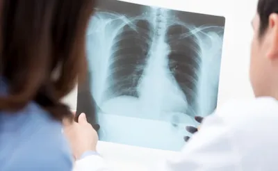 Рентген легких – цена в Москве, сделать рентгенографию легких в медицинском  центре Медскан