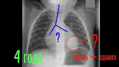 Рентген грудной клетки в Киеве | М24