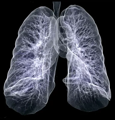 Рентген для легких: купить по выгодной цене в «СаФаир»