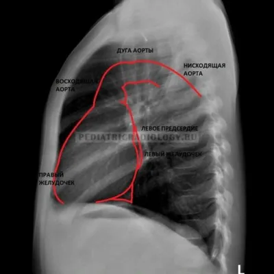 Проведение рентгена легких и флюорографии: показания и противопоказания