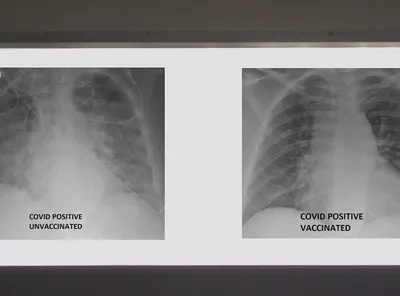 Рентген легких азиатской женщины для медицинского диагноза | Премиум Фото