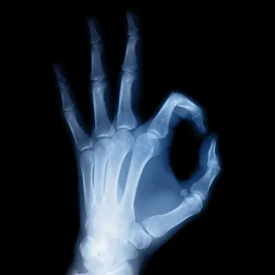 Рентгеновские лучи | Кругозор | Дзен