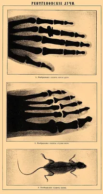Рентгеновские лучи | Кругозор | Дзен