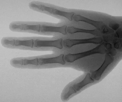 Рентгеновские лучи - нечаянно открыл …» — создано в Шедевруме