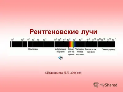 В ДВФУ разработали аппарат Илизарова, который пропускает рентгеновские лучи  - Российская газета