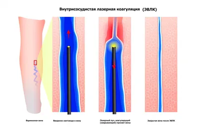 Я хотела порезать себе вены. Просто было интересно, что чувствует человек…  | Жизнь вокруг | Дзен