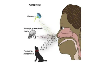 Лечение медикаментозного ринита