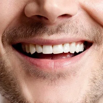 Человек показывая рот без зубов Стоковое Фото - изображение насчитывающей  подбородок, сторона: 68112802
