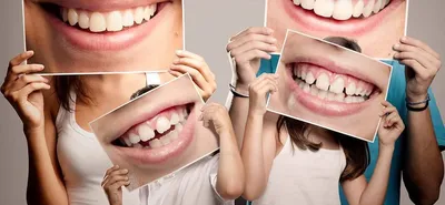 Straumann - С Днем стоматолога 🦷⠀ ⠀ Уважаемые доктора, с праздником!  Каждый день вы делаете мир ярче: дарите своим пациентам новые улыбки, а  всем окружающим отличное настроение. Не останавливайтесь, а об остальном