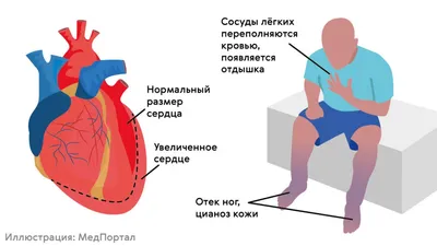 Съедобная картинка на торт Сердце (24х20 см) - купить по доступной цене