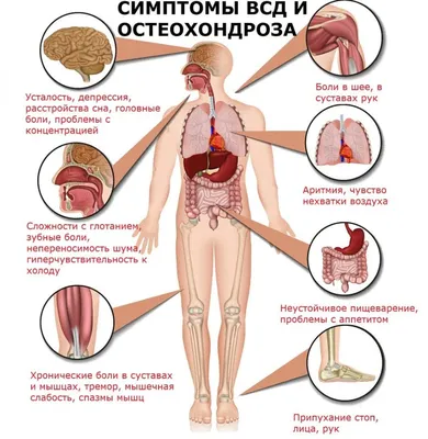 Лечение остеохондроза шейного отдела позвоночника симптомы, причины,  диагностика