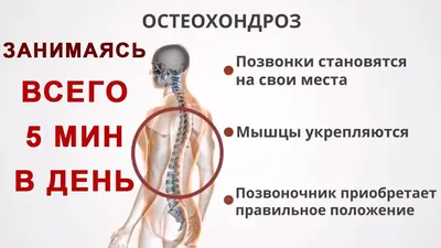 Остеохондроз - лечение в Киеве - Vertebra