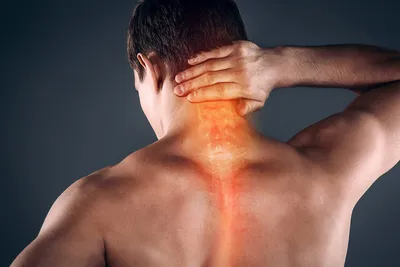 Как распознать шейный остеохондроз: 5 ключевых симптомов, на которые  следует обратить внимание | Клиника «Ноосфера» | Дзен