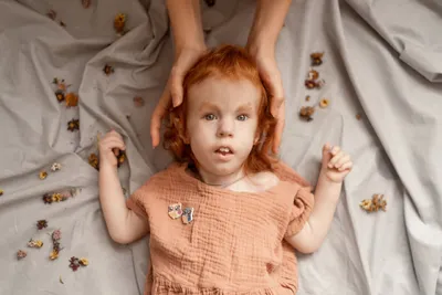 Лишняя 18-я хромосома: как живут дети с редким синдромом Эдвардса | Помощь  редким | Дзен