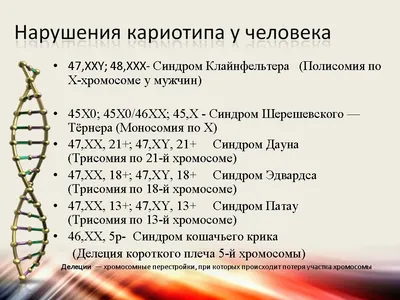 КЛИНИЧЕСКИЙ СЛУЧАЙ ПАЦИЕНТА С СИНДРОМОМ ЭДВАРДСА – тема научной статьи по  клинической медицине читайте бесплатно текст научно-исследовательской  работы в электронной библиотеке КиберЛенинка