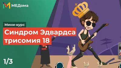 синдром Эдвардса (трисомия 18) — УЗИ Пятигорск Шухнин Р. Е.