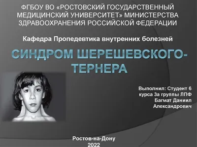 💥СЛУЧАЙ ИЗ ПРАКТИКИ Недавно с коллегой обсуждали генетические заболевания,  затронули такой синдром, как Синдром Шерешевского-Тернера.… | Instagram