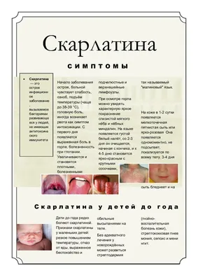 Скарлатина | 10.04.2023 | Воткинск - БезФормата
