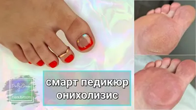 Смарт педикюр (ФОТО) - новейшая технология заботы о ногтях и коже стоп -  trendymode.ru
