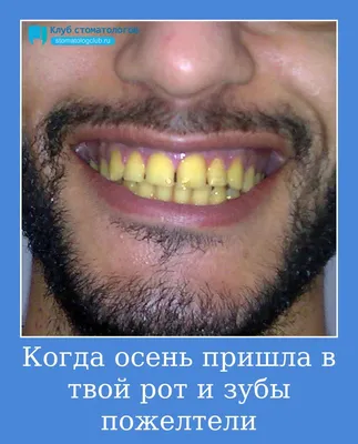 Прикол \"Зубы кролика\" светоотражающие (328526) - Купить по цене от 7.14  руб. | Интернет магазин SIMA-LAND.RU