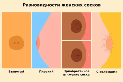 Проблема втянутого соска и методы её устранения, статьи клиники Бикод в  Москве