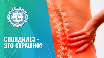 Спондилез - диагностика и лечение в Москве