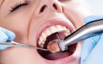 Современная стоматология: от лечения до протезирования