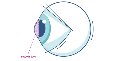 Деструкция стекловидного тела глаза – что это, причины, симптомы, лечение