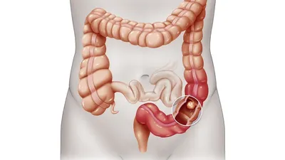 Пищеварительная система человека (анатомия желудка). 3D: стоковая  иллюстрация, 774494704 | Shutterstock
