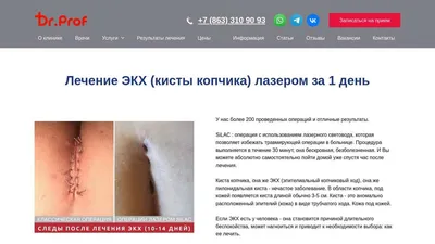 Киста копчика - операция лазером: цена удаления кисты копчика и отзывы в  Оксфорд Медикал Киев