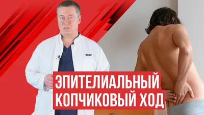 Киста копчика | Екатерина Аксентьева | Дзен