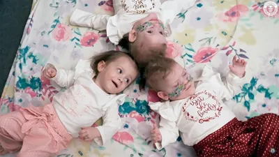 Самые недоношенные в мире тройняшки попали в Книгу рекордов Гиннесса | РБК  Life