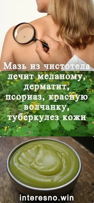 Туберкулез и дети