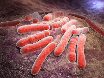 Милиарный туберкулез - причины появления, симптомы заболевания, диагностика  и способы лечения