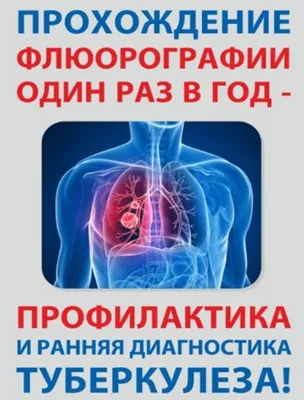 Туберкулез является чрезвычайно распространенной инфекционной болезнью |  Национальный портал “Адырна”