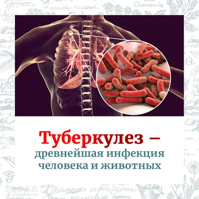 Туберкулез – история 7 000 лет - ГКБ имени В.П. Демихова