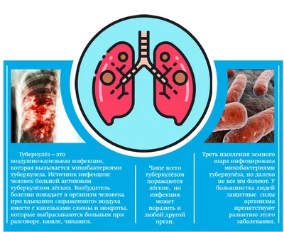 Туберкулёз и COVID-19: что важно знать людям с ТБ для успешного лечения  (видео)