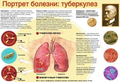 ПРЕСС-РЕЛИЗ Чем опасен туберкулез? - Страничка ЗОЖ - Гомельская областная  клиническая больница