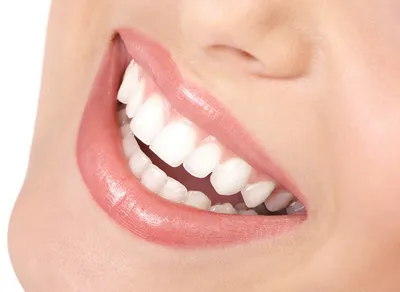 Формула идеальной улыбки — стоматология метро Каширская