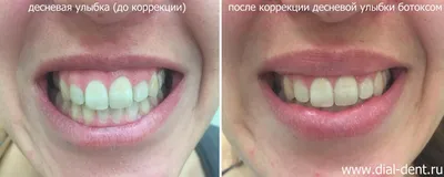 Секрет загадочной улыбки Моны Лизы раскрыли медики - KP.RU
