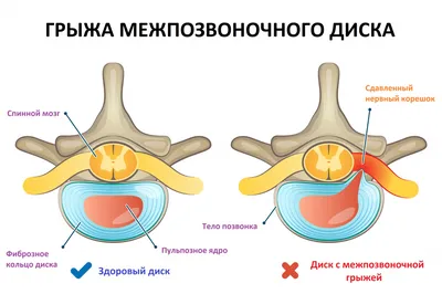 Лечение: истории из жизни, советы, новости, юмор и картинки — Горячее |  Пикабу