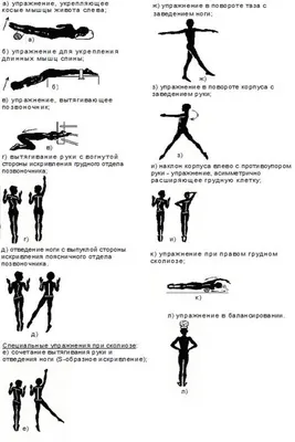 Кифоз. Лечение кифоза спины в Киеве. Коррекция осанки методом кинезитерапии